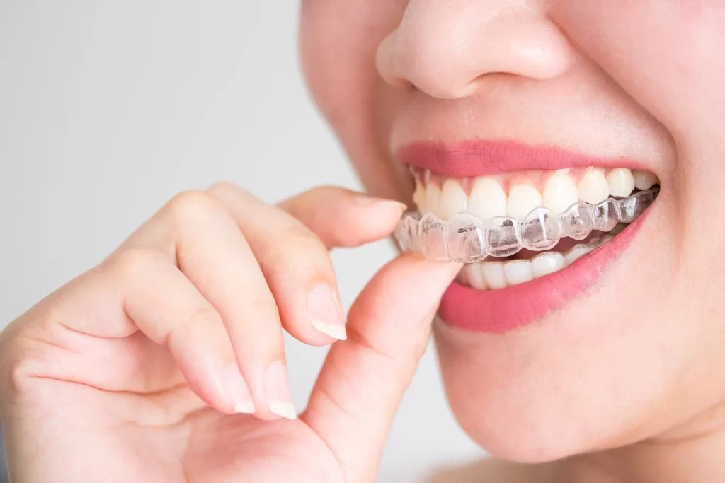Woman holding Invisalign.