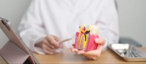 A cropped shot of a dentist holding a tooth anatomy model, explaining oral health and tooth decay while discussing how long a root canal takes to heal.