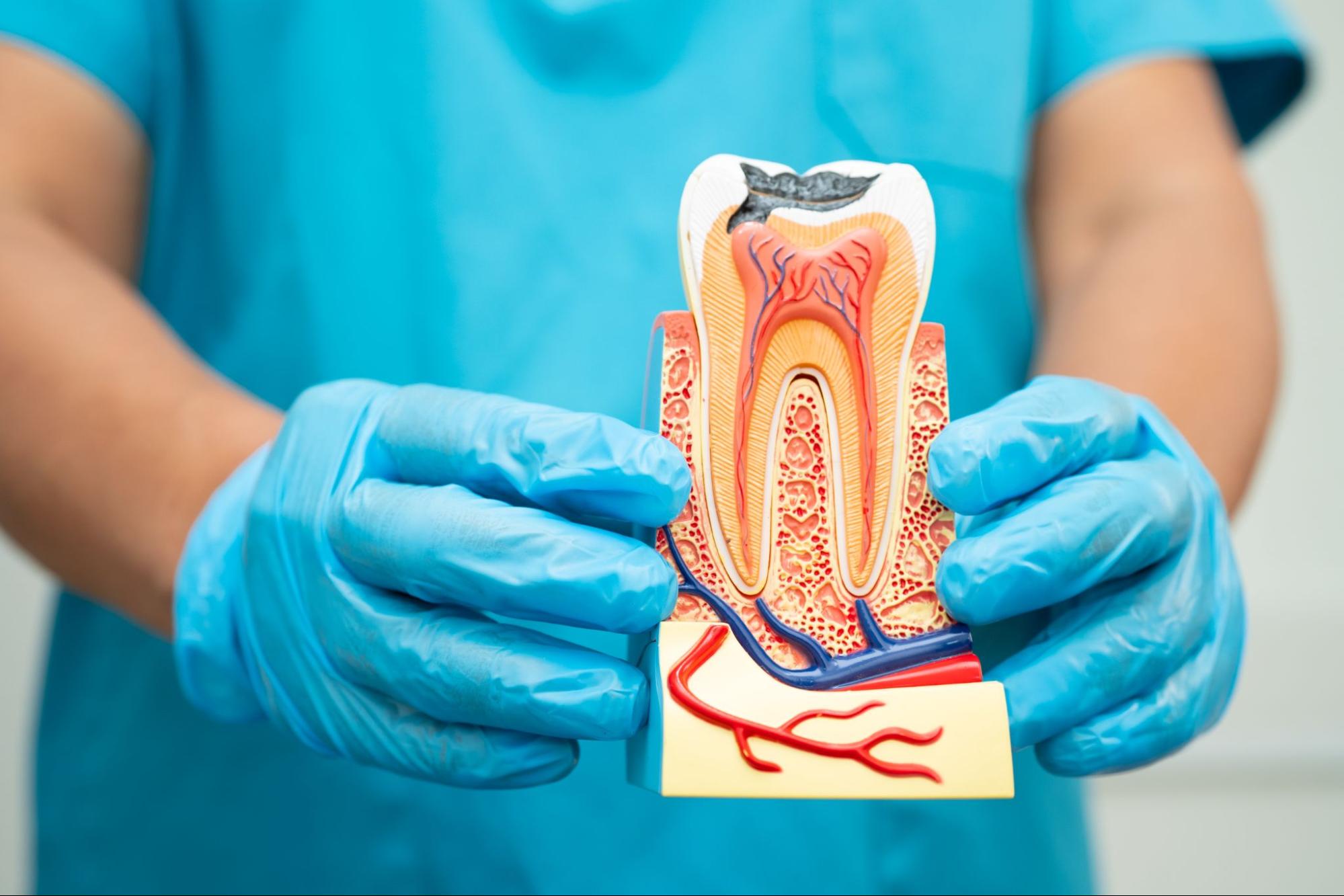Dentist with gloves holding a model of a tooth.
