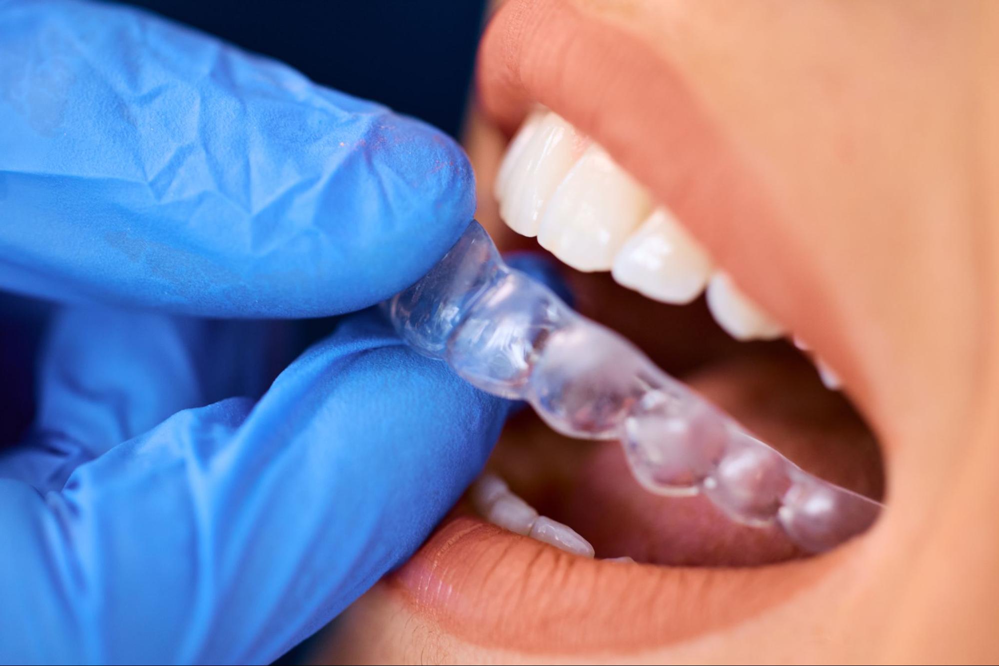 A dentist placing Invisalign® aligners on a female patient’s teeth.