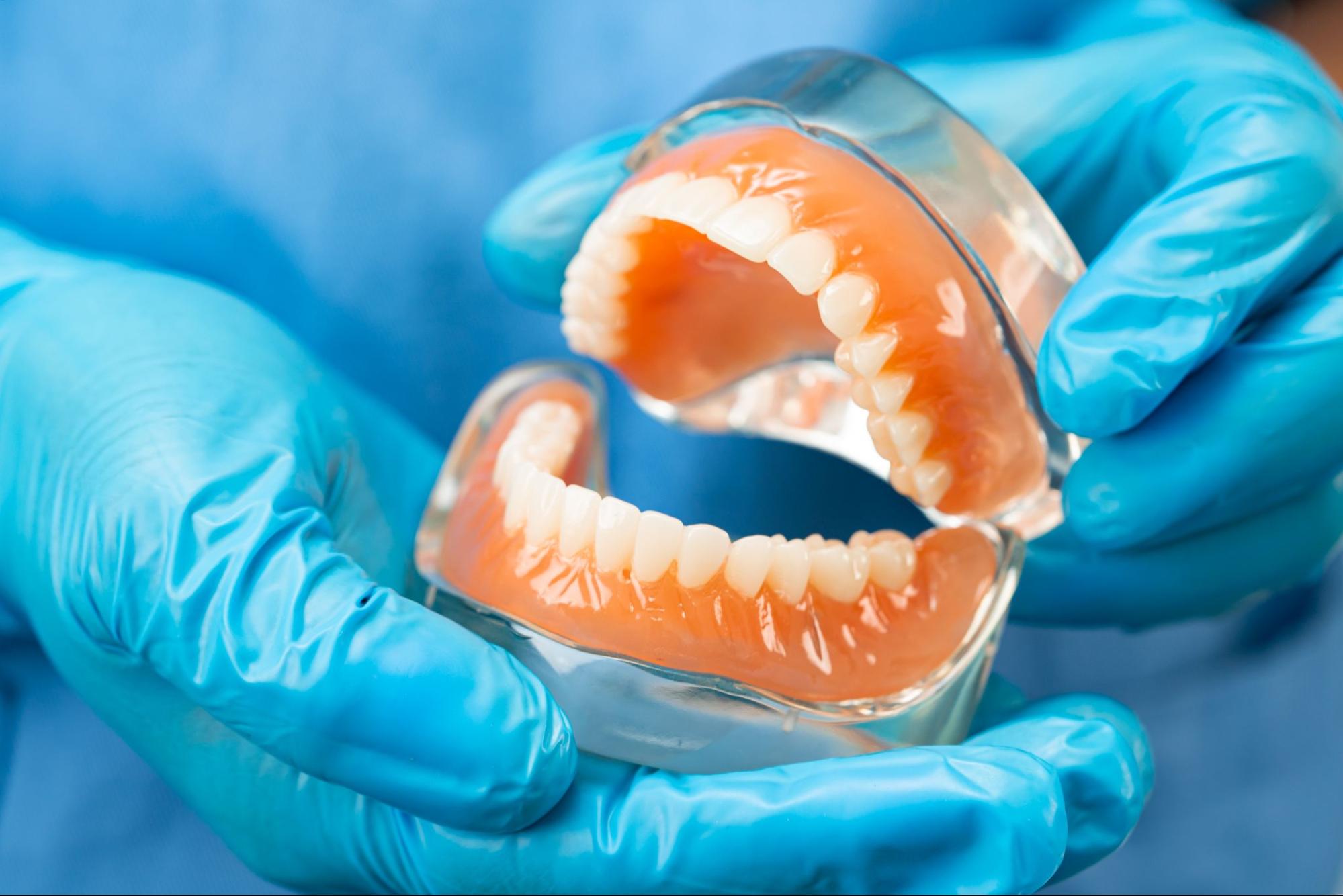 A close-up of a dentist's hands wearing blue gloves holding a complete denture set in a plastic case.