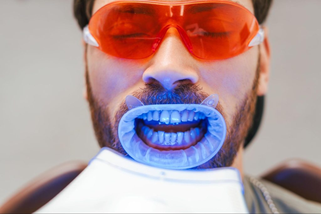 A close-up of a bearded man receiving professional teeth whitening in a clinic.