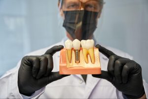 A dentist in a mask and face shield shows a dental model with an implant.