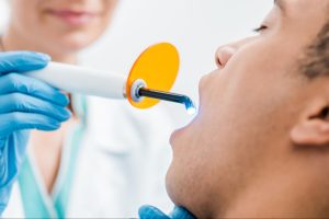 Close-up of an African American man receiving a dental sealant treatment.